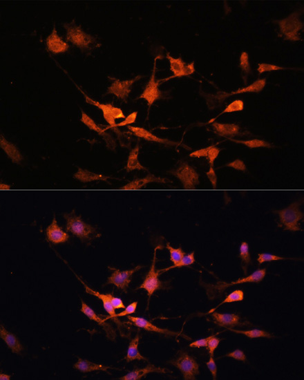 KEAP1 Polyclonal Antibody (E-AB-67032)