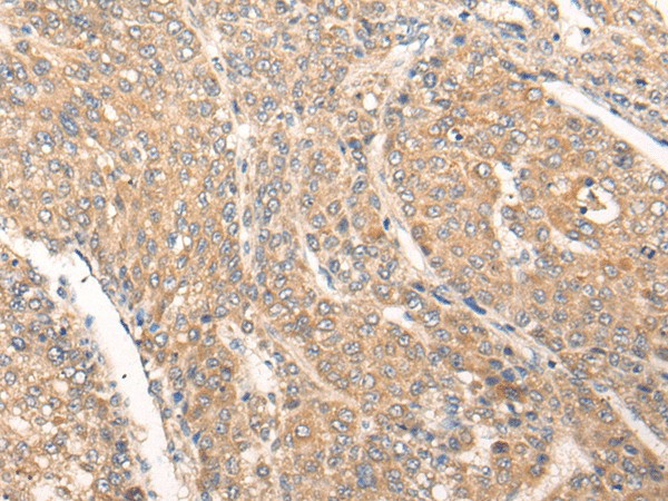 PIAS3 Polyclonal Antibody (E-AB-19322)