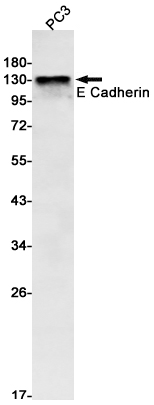 Recombinant E Cadherin Monoclonal Antibody (E-AB-81424)
