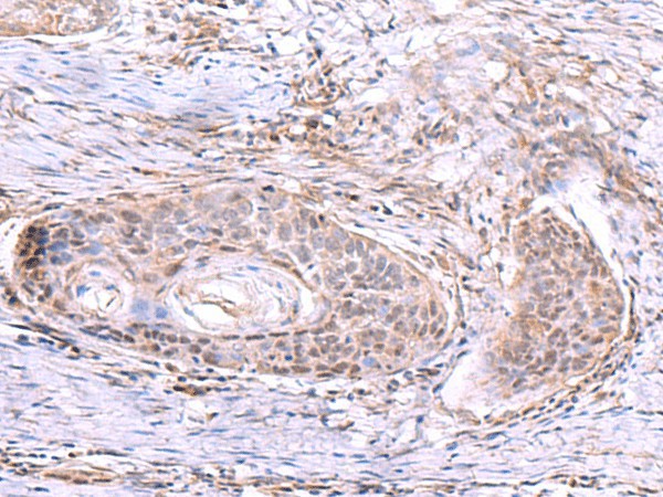 AKAP17A Polyclonal Antibody (E-AB-52956)