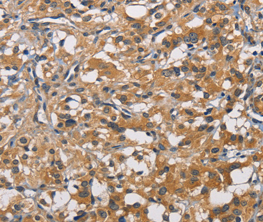 PIKFYVE Polyclonal Antibody (E-AB-10902)