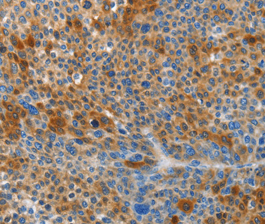 HTRA3 Polyclonal Antibody (E-AB-13006)