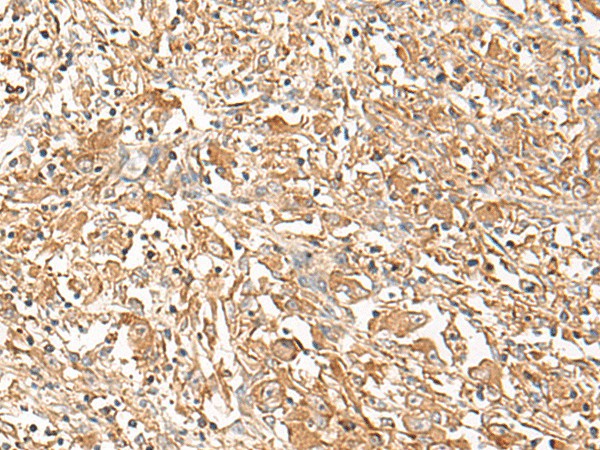 CORO2A Polyclonal Antibody (E-AB-18735)