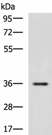 IBSP Polyclonal Antibody (E-AB-52125)
