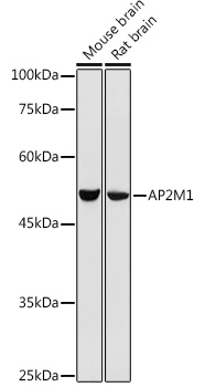 AP2M1 Polyclonal Antibody (E-AB-90720)