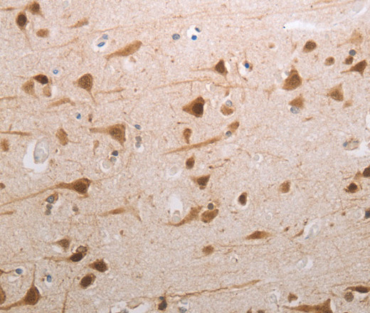 MDC1 Polyclonal Antibody (E-AB-12802)