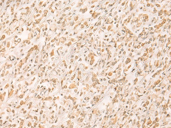 SETD1A Polyclonal Antibody (E-AB-18095)