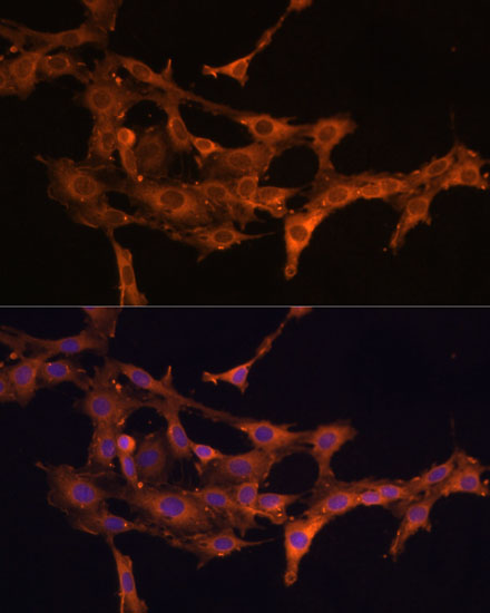 DCN Polyclonal Antibody (E-AB-66406)