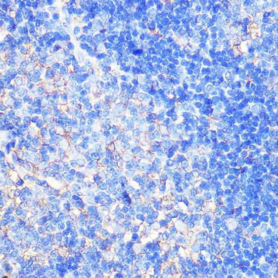 XCR1 Polyclonal Antibody (E-AB-92208)