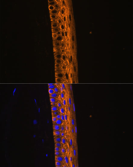 MYH13 Polyclonal Antibody (E-AB-65053)