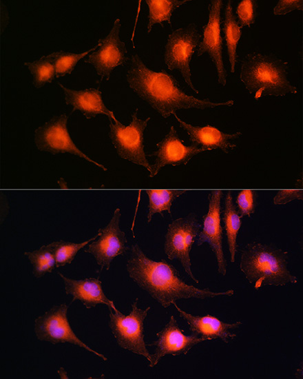 Tau Polyclonal Antibody (E-AB-65652)