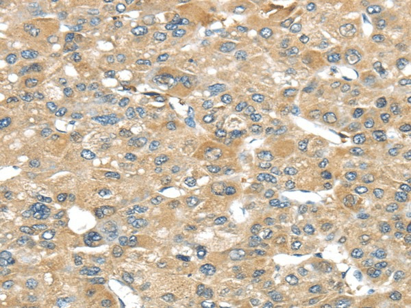 SRP54 Polyclonal Antibody (E-AB-17035)
