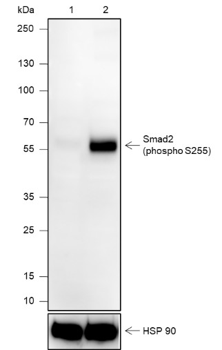 Recombinant Phospho-Smad2 (S255) Monoclonal Antibody (AN302094L)
