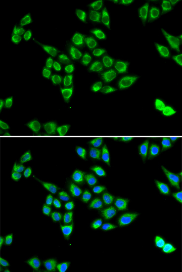 PC Polyclonal Antibody (E-AB-61871)