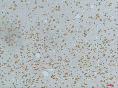 Phospho-CAMK2 beta/gamma/delta (Thr287) Monoclonal Antibody (E-AB-51035)