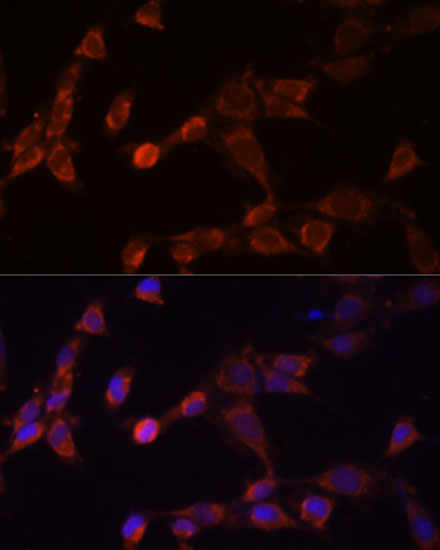 PSMD14 Polyclonal Antibody (E-AB-63456)