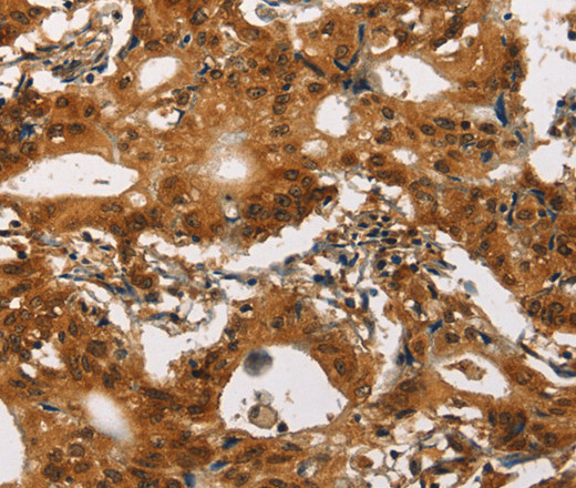 Cav1.2 Polyclonal Antibody (E-AB-13100)