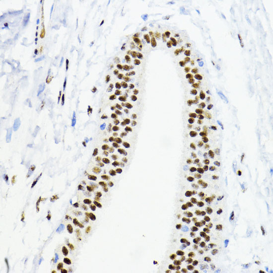 ZEB1 Polyclonal Antibody (E-AB-67683)