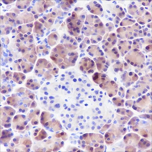 Recombinant SPINK1 Monoclonal Antibody (AN301663L)