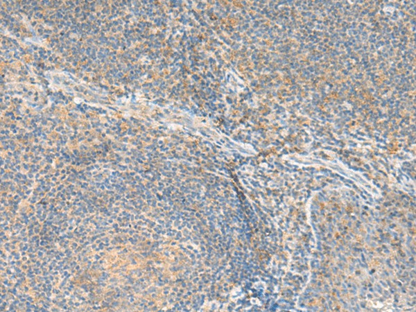RNF207 Polyclonal Antibody (E-AB-19874)