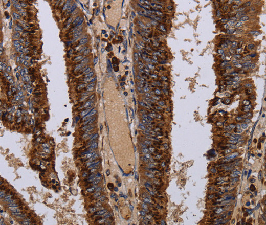 PPP1R1B Polyclonal Antibody (E-AB-14928)