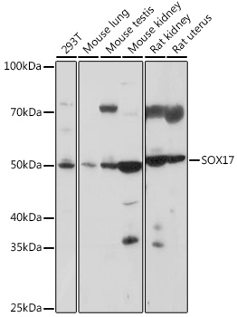 SOX17 Polyclonal Antibody (E-AB-92135)