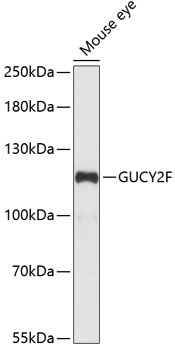 GUCY2F Polyclonal Antibody (E-AB-64960)