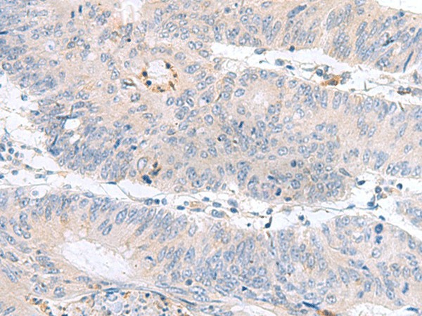 PDE6D Polyclonal Antibody (E-AB-53046)