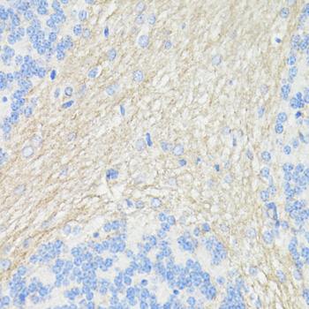 THY1 Polyclonal Antibody (E-AB-67004)