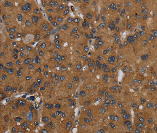 ID2 Polyclonal Antibody (E-AB-15069)