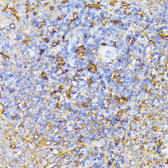 VEGF Receptor 1 Polyclonal Antibody (E-AB-65963)