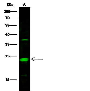 Recombinant MESDC2 Monoclonal Antibody (AN300356P)