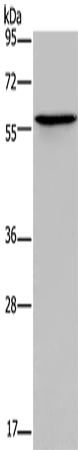 ADRA1B Polyclonal Antibody (E-AB-12279)