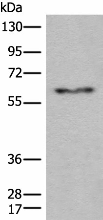 CES2 Polyclonal Antibody (E-AB-19698)
