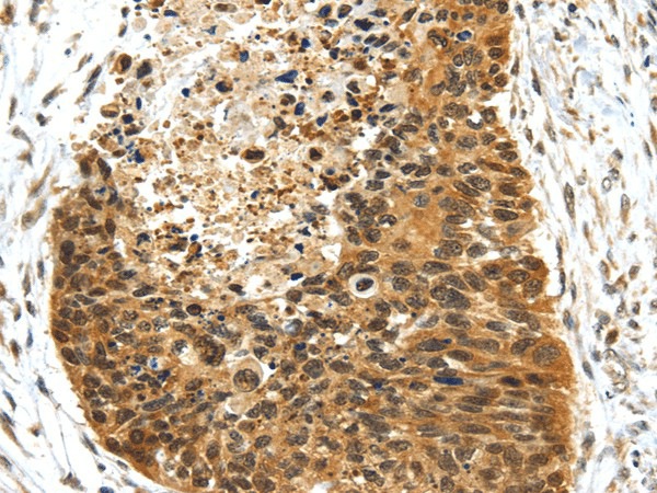 NR2F2 Polyclonal Antibody (E-AB-17411)