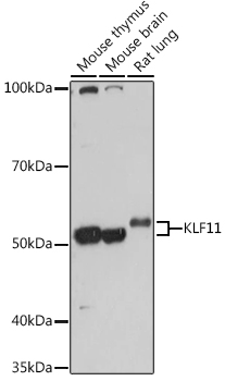 KLF11 Polyclonal Antibody (E-AB-92111)