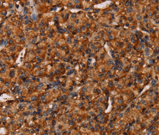 COL18A1 Polyclonal Antibody (E-AB-13213)