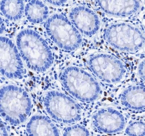Recombinant IGJ Monoclonal Antibody (AN301796L)