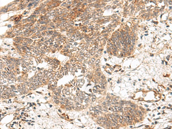 GRASP Polyclonal Antibody (E-AB-17995)