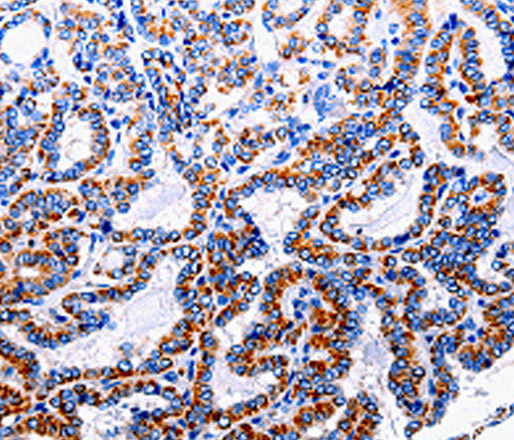 NFκB-p105 Polyclonal Antibody (E-AB-13851)