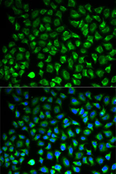 MAOA Polyclonal Antibody (E-AB-66199)