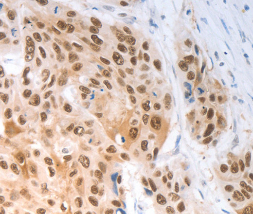 SLC22A8 Polyclonal Antibody (E-AB-16017)