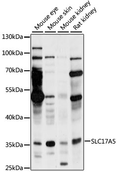 SLC17A5 Polyclonal Antibody (E-AB-91152)