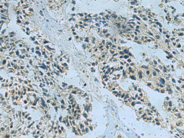 NDUFA2 Polyclonal Antibody (E-AB-18269)