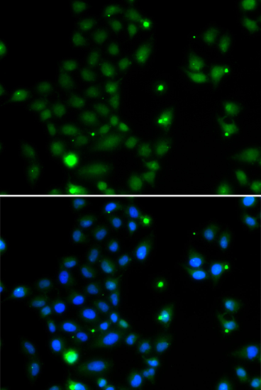 GCM1 Polyclonal Antibody (E-AB-61617)