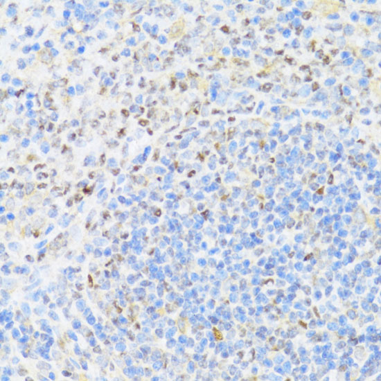 UQCC2 Polyclonal Antibody (E-AB-65650)