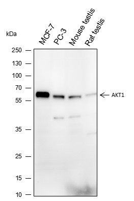 Recombinant AKT1 Monoclonal Antibody (AN301428L)
