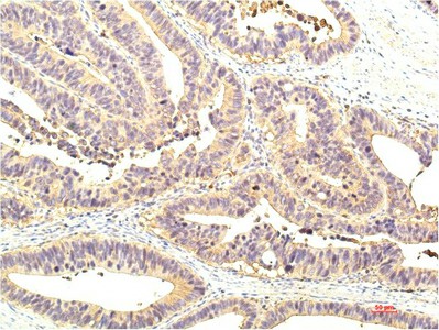 STAT1 Monoclonal Antibody (E-AB-22201)