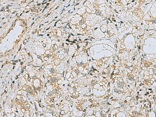 RAB3IP Polyclonal Antibody (E-AB-53118)