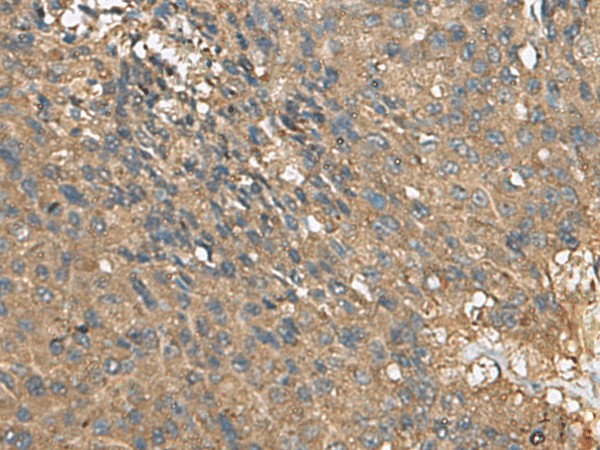 EIF1AX Polyclonal Antibody (E-AB-53041)